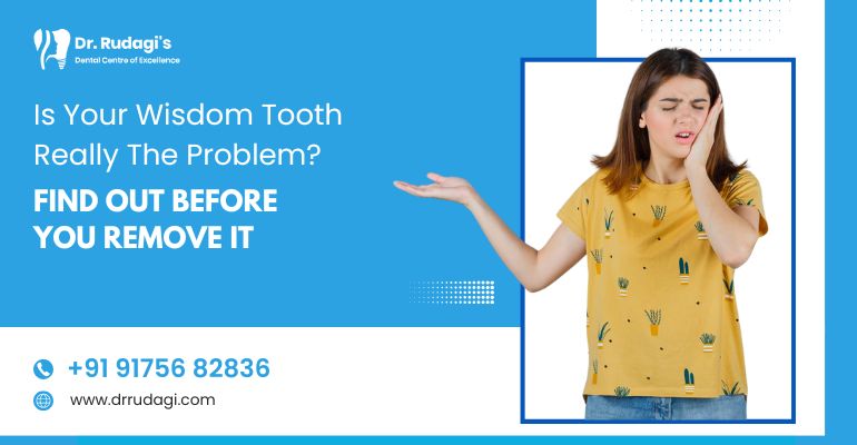Is Your Wisdom Tooth Really the Problem? Find Out Before You Remove It