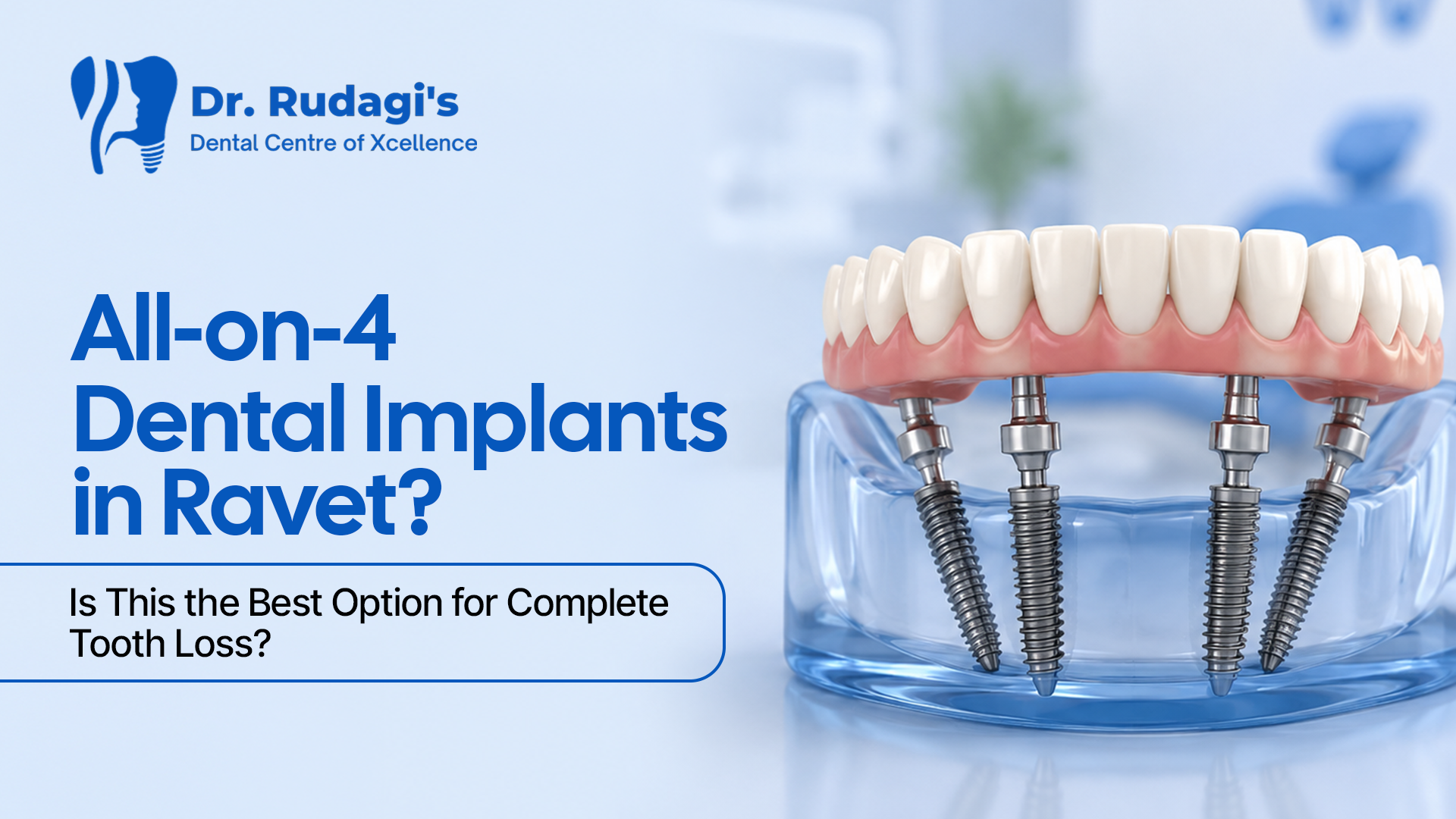 All-on-4 dental implants in Ravet for complete tooth loss