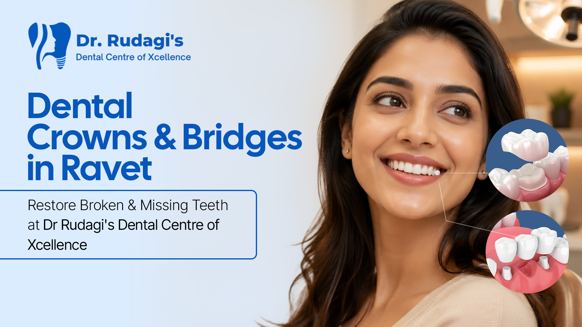Dental bridge treatment to replace missing teeth in Ravet
