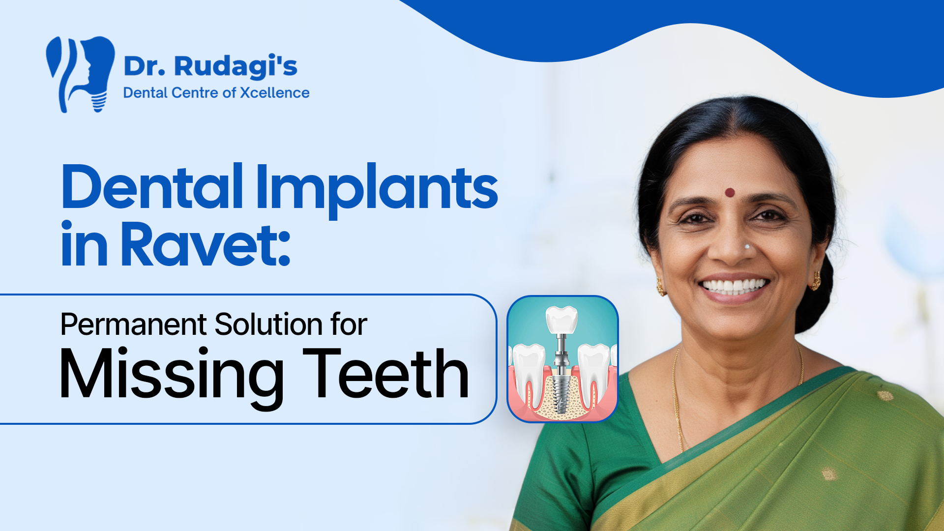 Dental Implants Treatment in Ravet: Permanent Solution for Missing Teeth