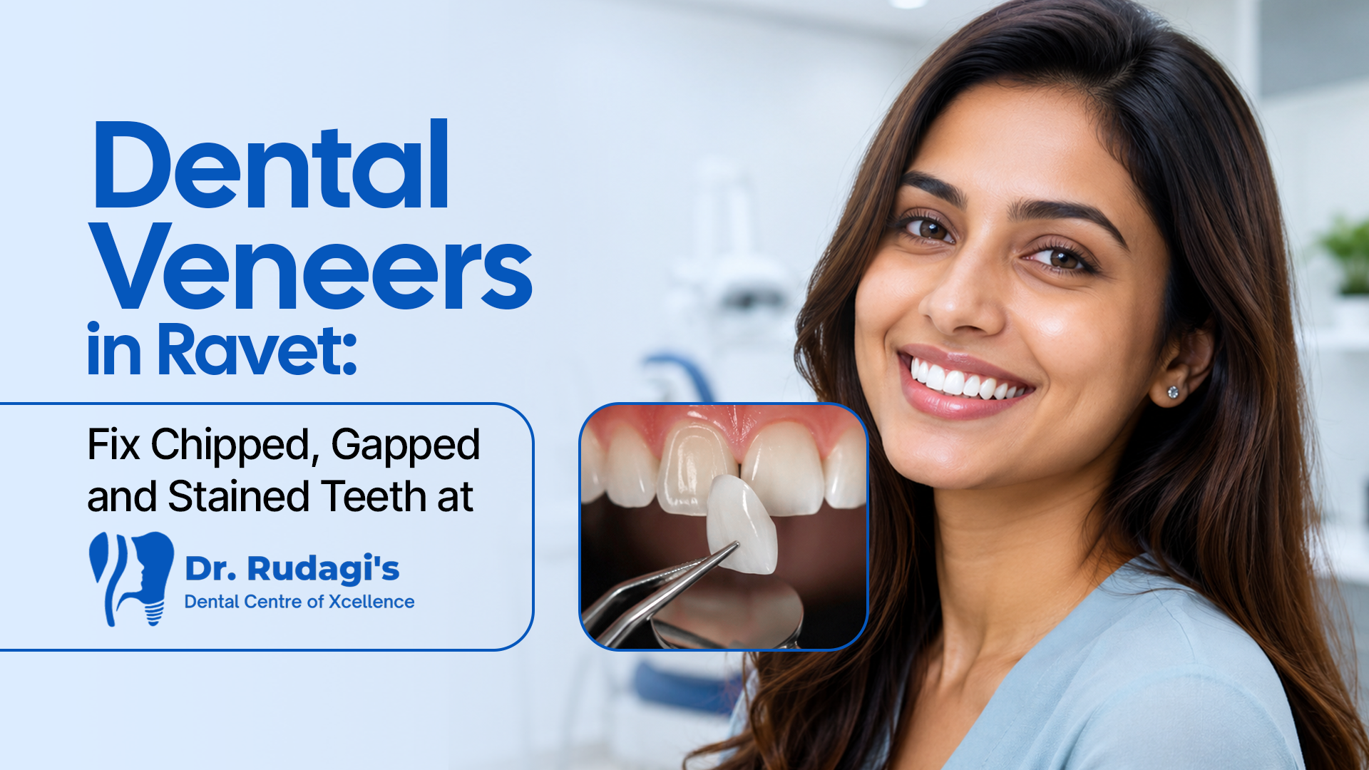 Dental Veneers in Ravet