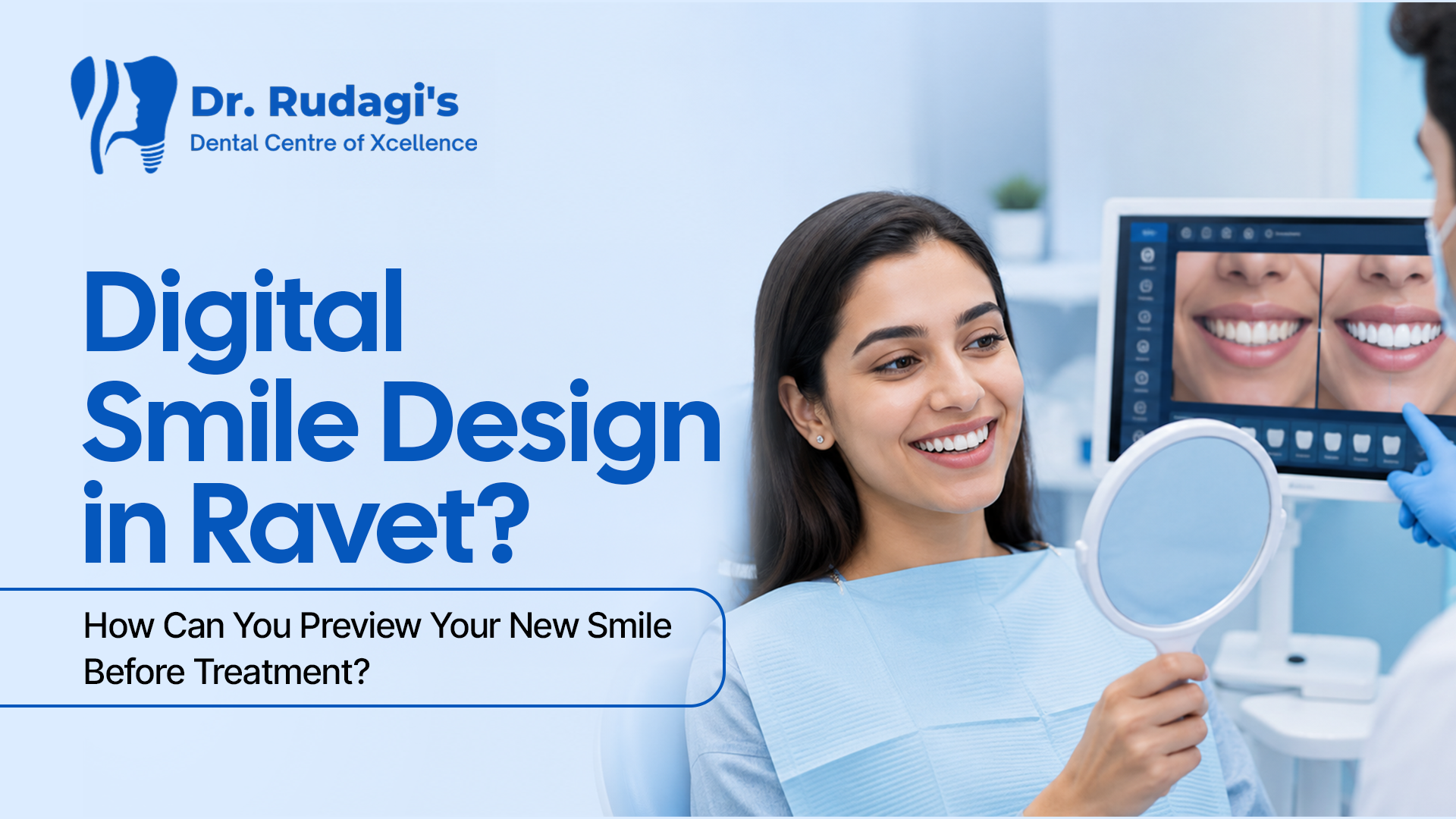 Digital Smile Design in Ravet with digital smile preview