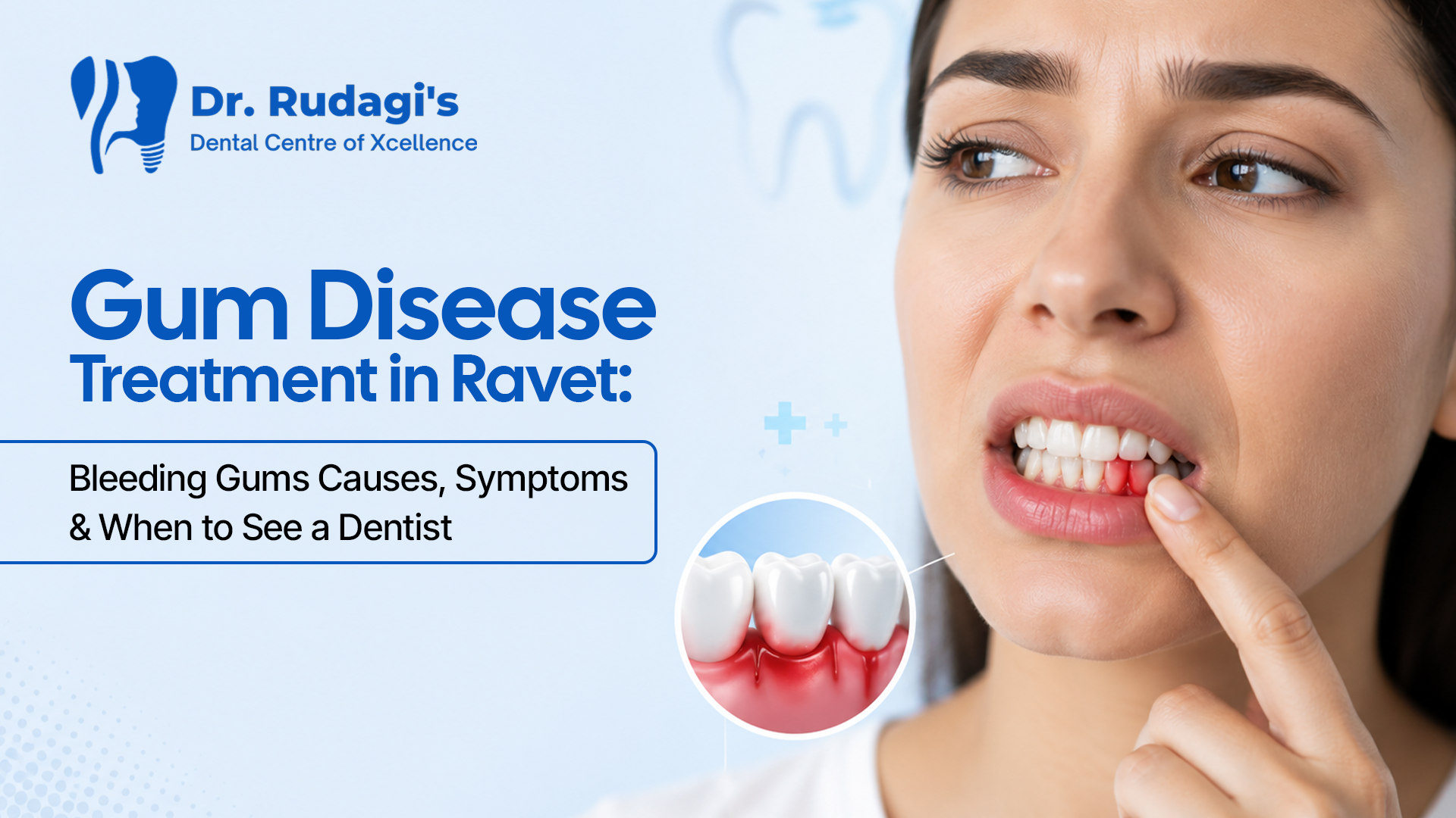 Gum disease treatment in Ravet for bleeding gums and healthy smile restoration