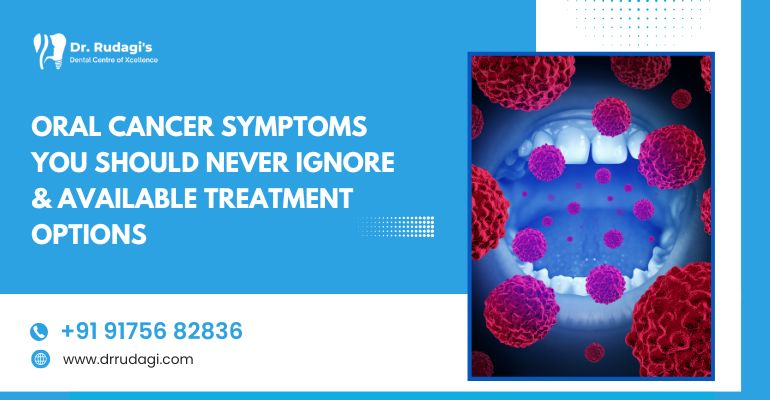 Oral Cancer Symptoms You Should Never Ignore & Available Treatment Options