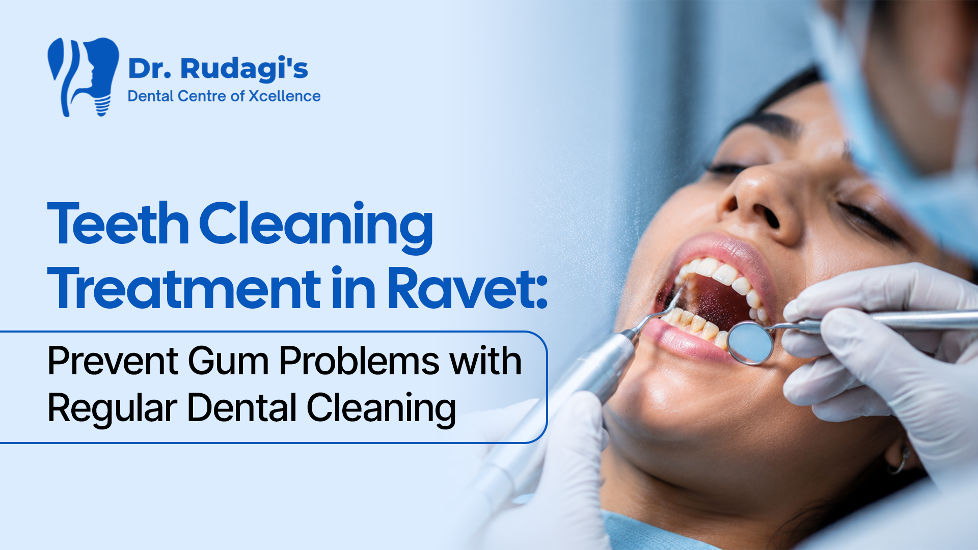 Teeth Cleaning Treatment in Ravet